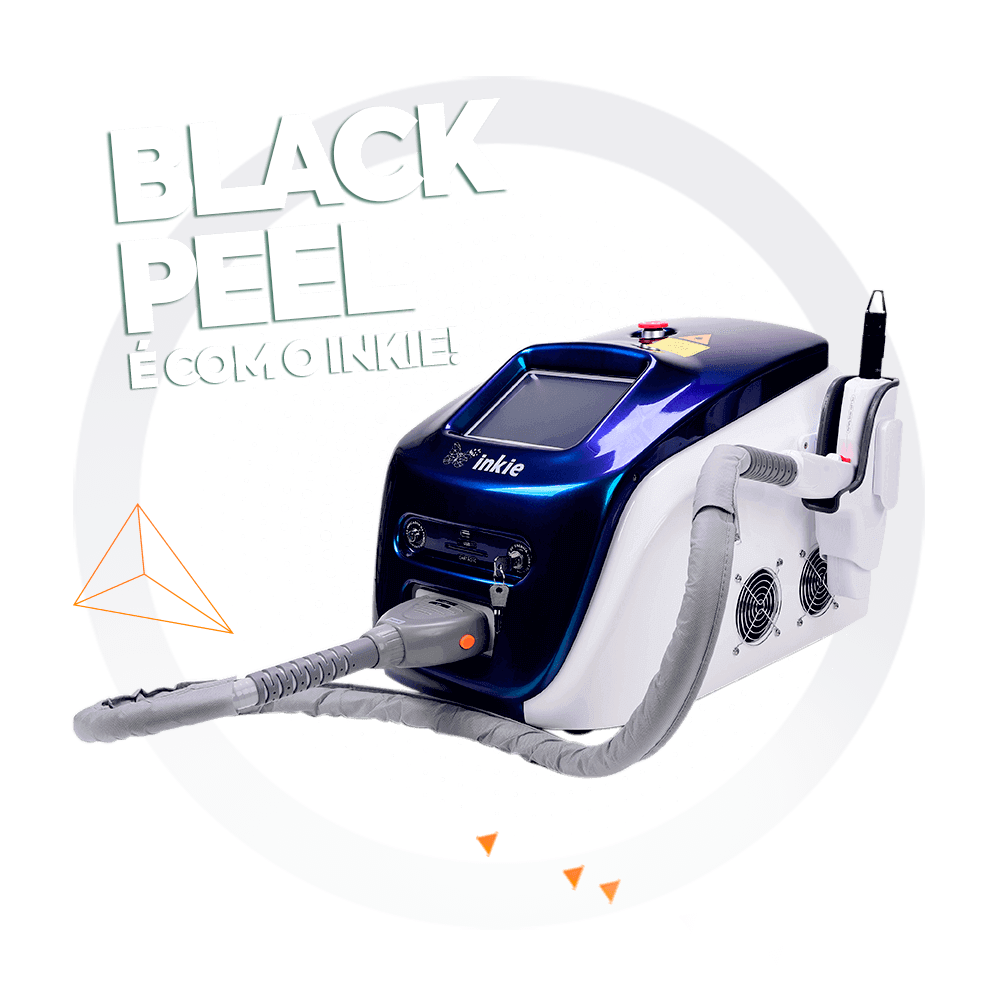 Inkie-laser-black-peel-tratamento