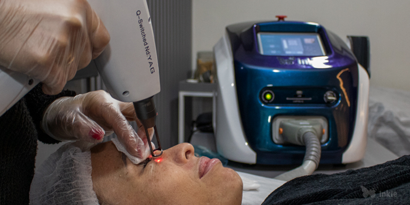 Aplicação do laser para tratamento de clarear a pele