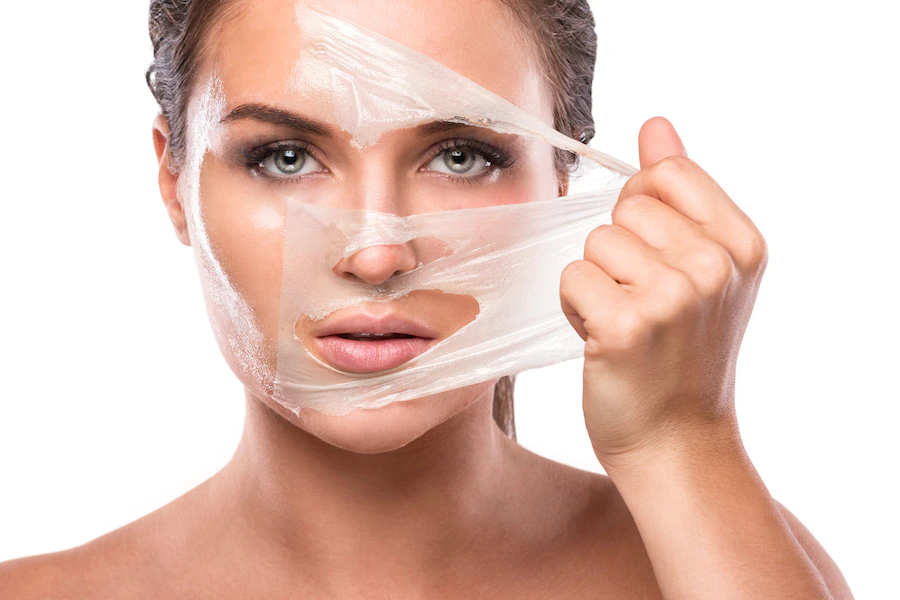 Mulher após fazer peeling químico