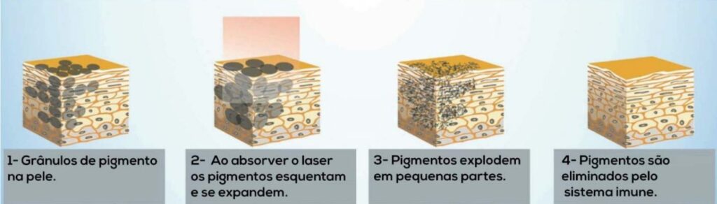 mecanismo de ação laser